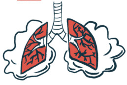lungs with bio marker